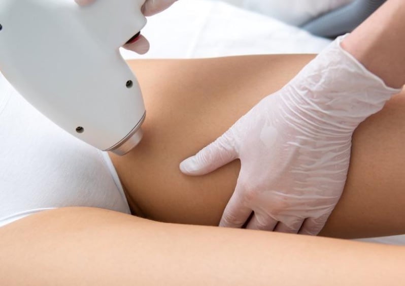 Epilation définitive Epilation définitive
